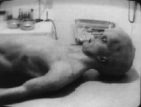 Alien autopsy